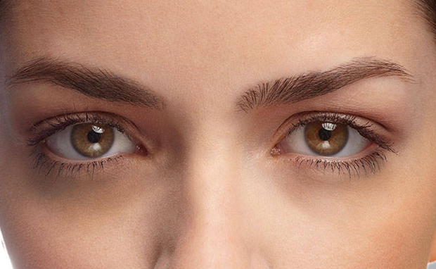 Como tratar as olheiras?