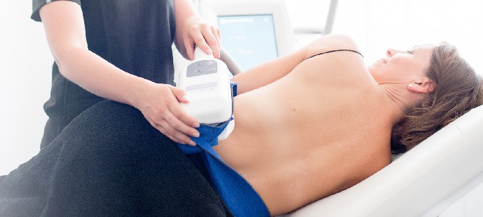 Tratamento da gordura localizada com a técnica CoolSculpting