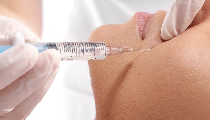 Preenchimento com ácido polilático atua no combate ao envelhecimento precoce da pele