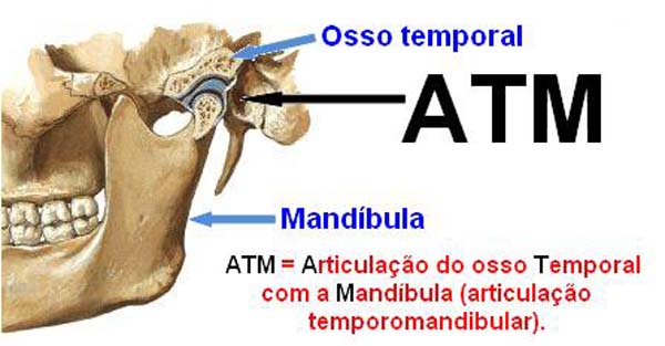 Disfunção da Articulação Temporomandibular 
