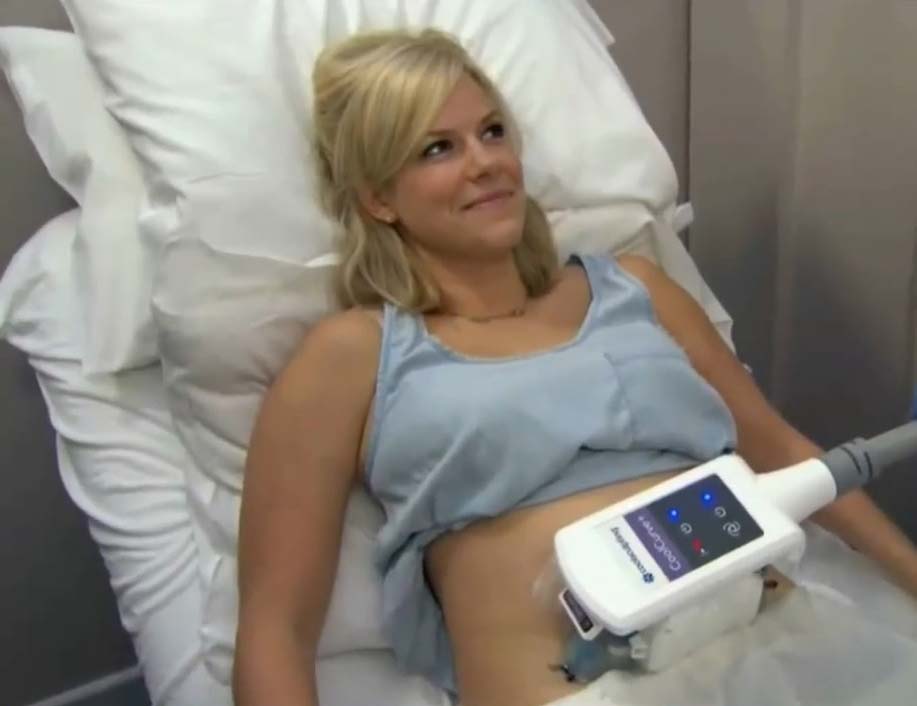 paciente realizando procedimento com coolsculpting