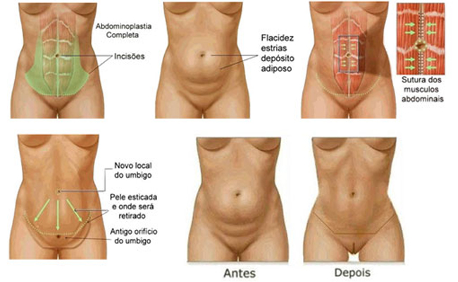 Palpar el abdomen