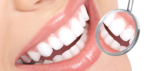 Restauração Dental