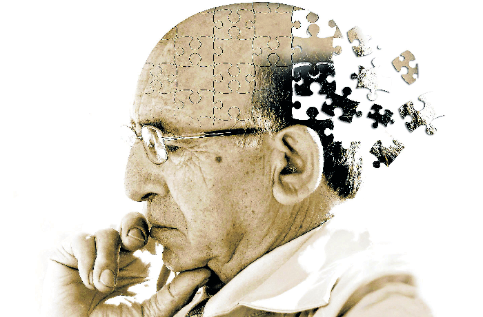 O cuidado que devemos ter para evitar o Alzheimer 